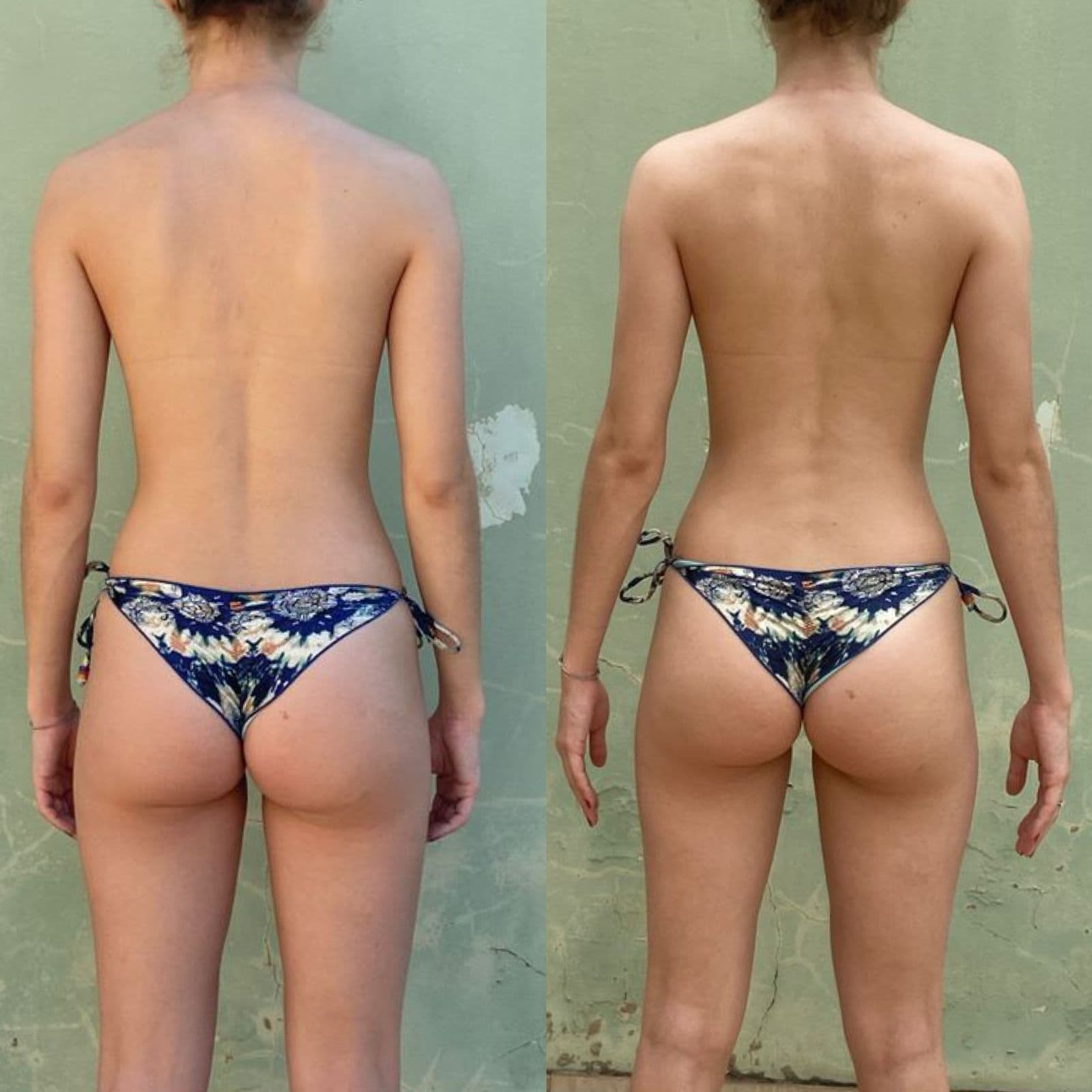 Resultado de transformação Resultado 3 - Anderson Gonçalves Personal Trainer