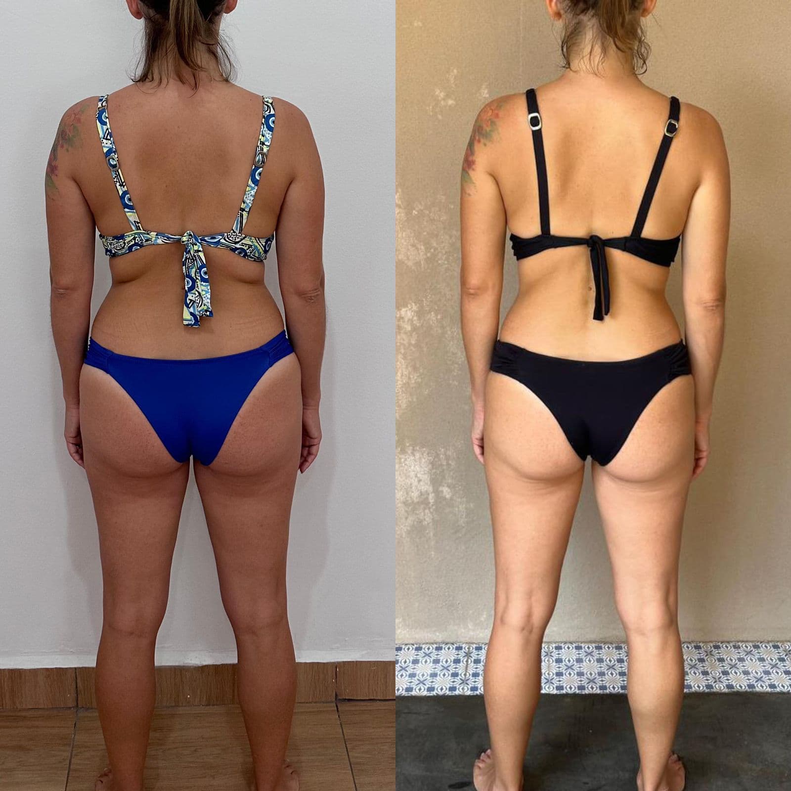 Resultado de transformação Resultado 4 - Anderson Gonçalves Personal Trainer