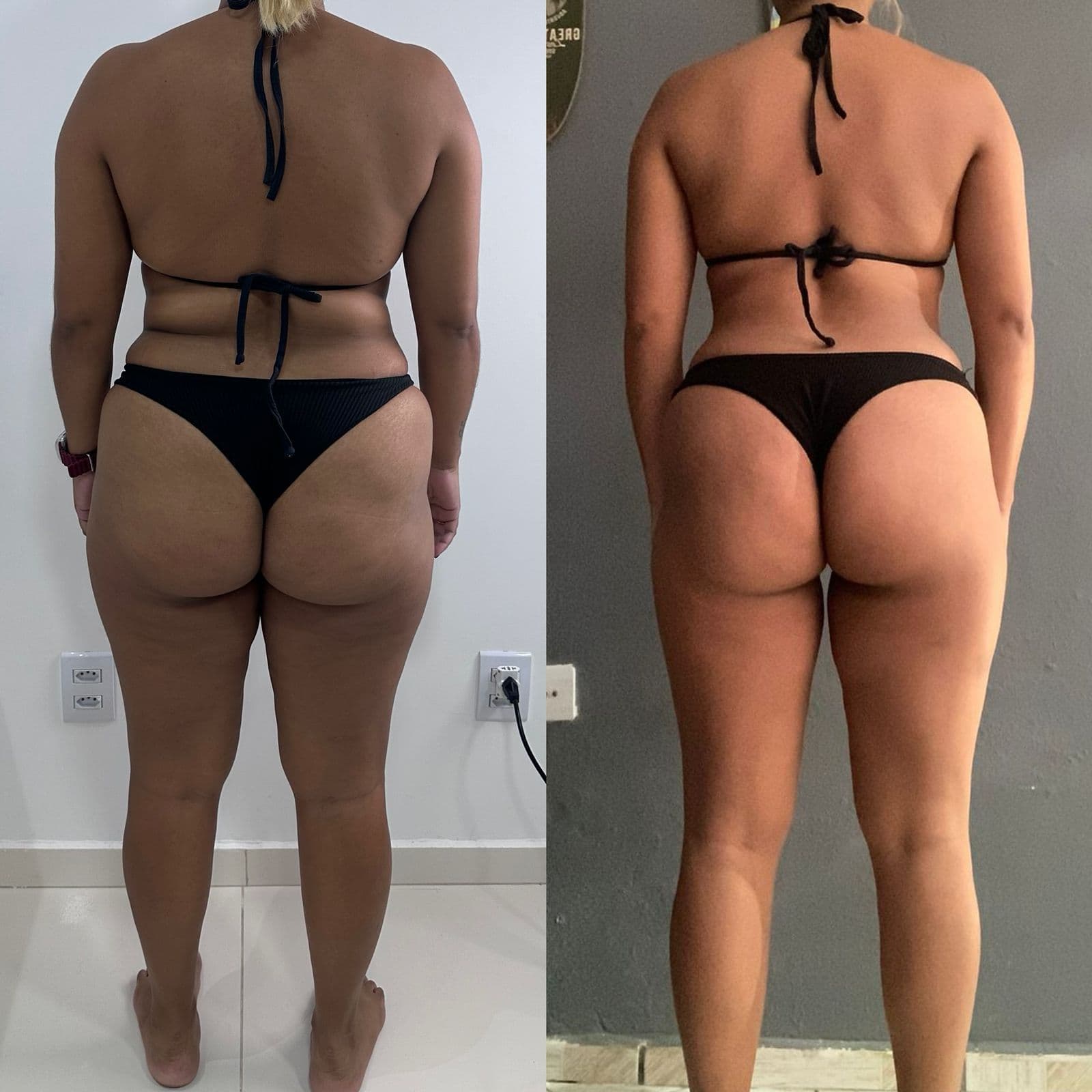 Resultado de transformação Resultado 5 - Anderson Gonçalves Personal Trainer