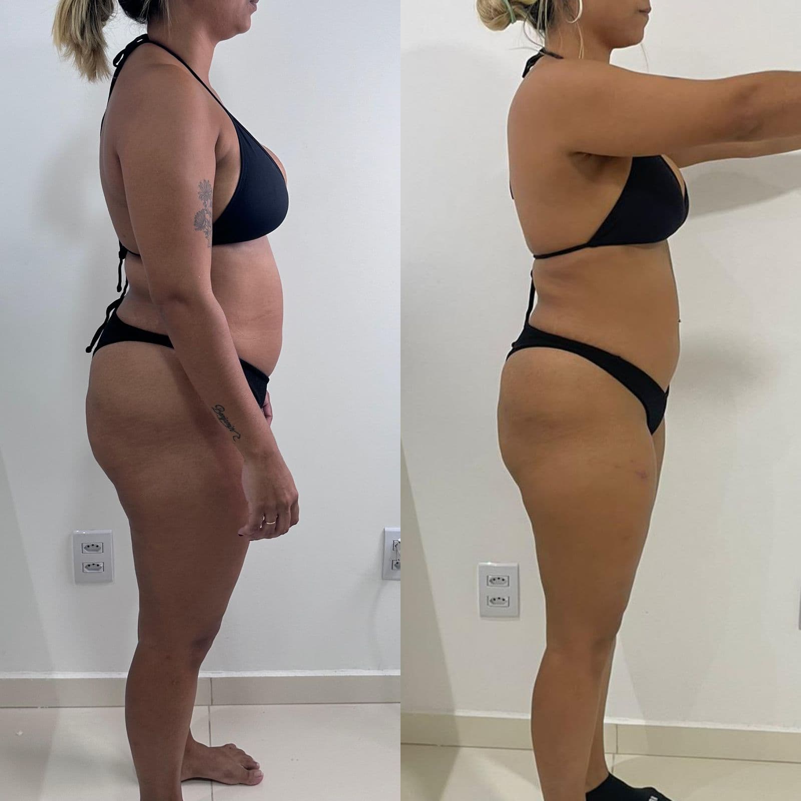 Resultado de transformação Resultado 6 - Anderson Gonçalves Personal Trainer